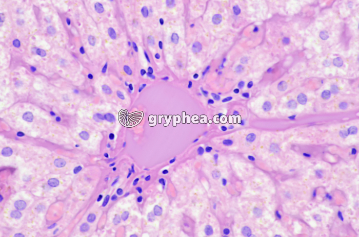 Cellules hépatiques x100 - gryphea.org